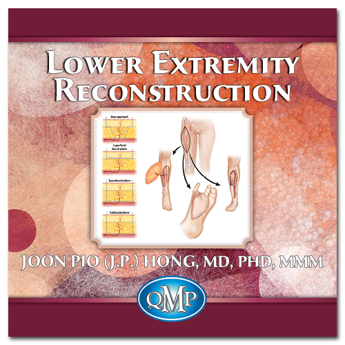 Lower Extremity Reconstruction with ALT Flap Microsurgery